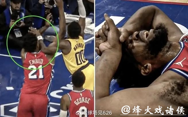 恩比德鼻子骨折76人不敌步行者 骑士力克奇才
